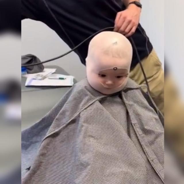 父母|宝宝头睡扁了,没想到戴上头盔却是这样的反应,网友看着都心疼