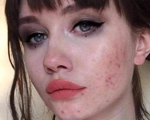 小胡子|子宫“脏兮兮”的女孩子，脸上会有这“3表现”，若一个都不占，恭喜了！