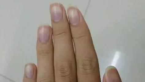 排毒|肝毒“重”的人，身体3处是“黑”的，如果你也有，尽早排毒