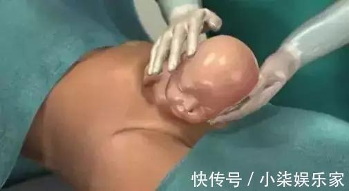 导尿管|剖腹产最痛是什么时候过来人的说法给你一些参考,孕妇早知道好