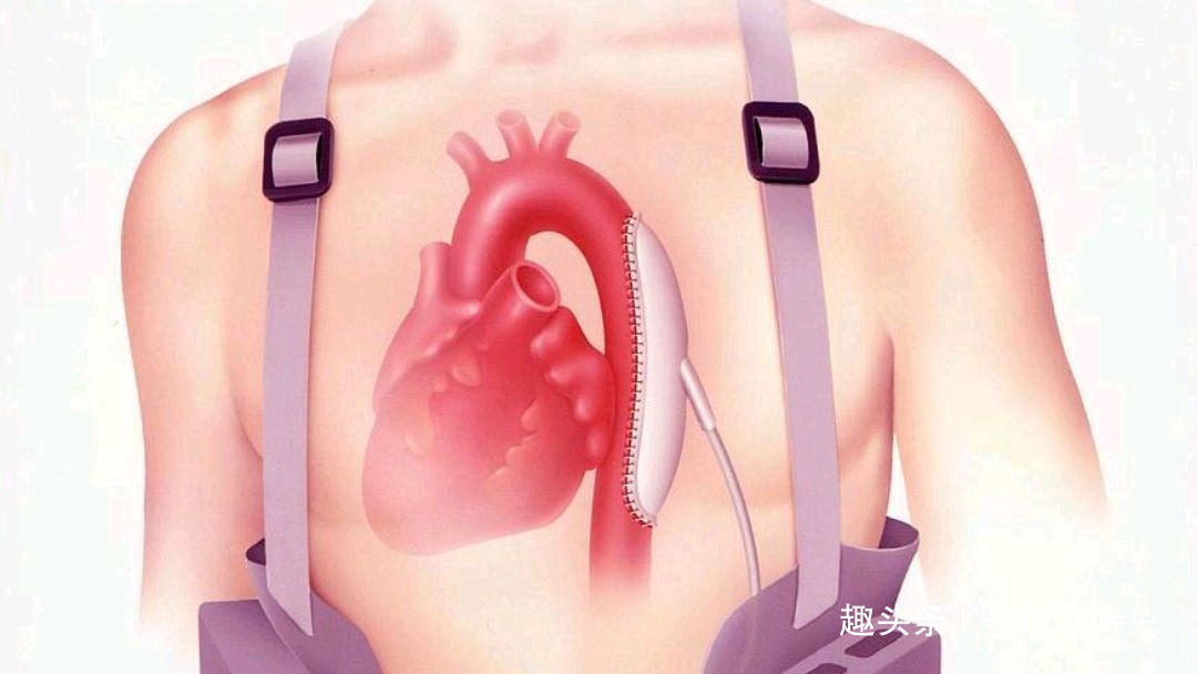 15个有趣冷知识现在的手机,为什么不使用可拆卸式电池