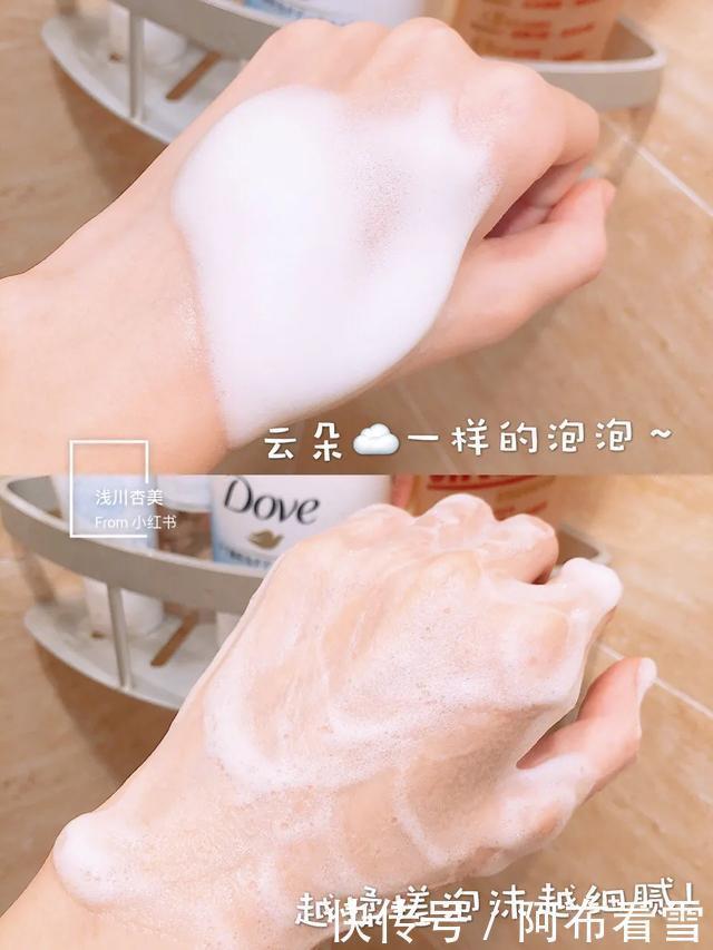 身体乳|鸡皮不敢露?其实不止你们,明星也有鸡皮肤