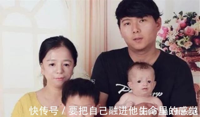 孩子|“鸟脸”妈妈执意生二胎,孩子不幸被遗传,一时的冲动毁孩子一生