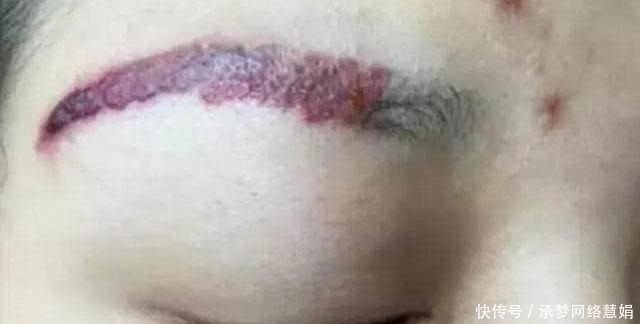 画眉|一个纹眉师的自白：为何我自己从不纹眉？看完你可能也不想纹了！