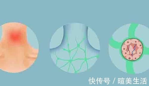 切除|癌症患者做完手术,已经把肿瘤切干净了,为何之后却还是复发了