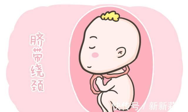 胎动|胎儿脐带绕颈真是准妈妈常摸肚子造成的看完这篇相信你就清楚了