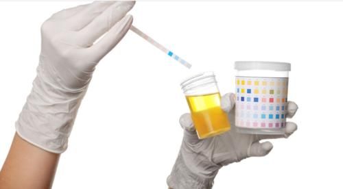 肾病|若查出尿蛋白1+,怎么办?医生:赶紧“3步走”,一步都不能少