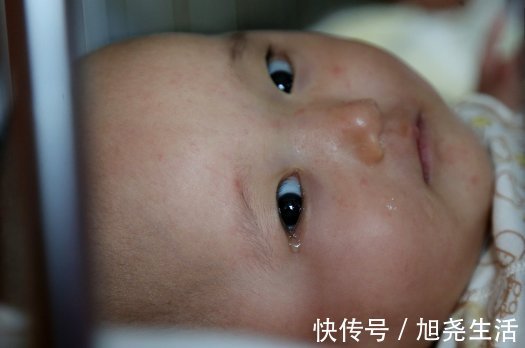 营养粥变成“有毒粥”，婴儿在7个月大时出现肾衰竭。记住补充食品的“三不”原则
