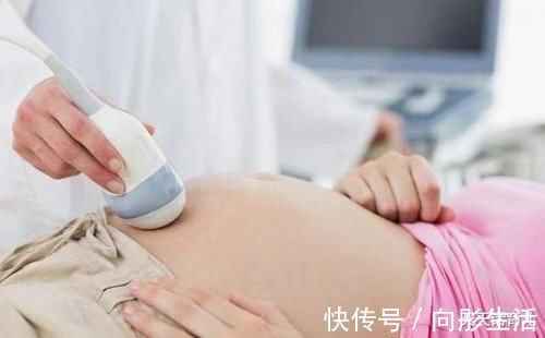 四维|为何有的医院做四维彩超不让家属陪?3大原因,孕妇有权知道