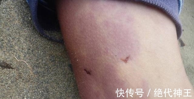 男子|男子在海上钓鱼,几小时后离奇死亡,医生给出诊断,家人捶打女儿