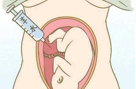 胎儿|怀孕几周最危险尤其是这两个时期,孕妇一定要知道