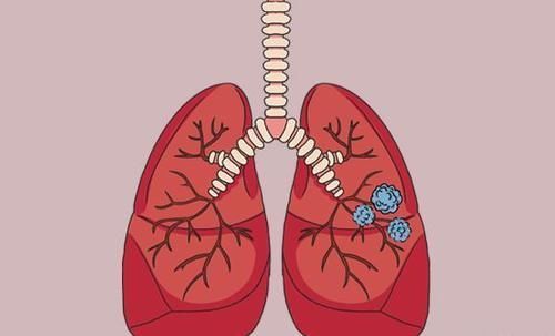 患上癌症|体检年年不落，为什么还是查出癌症晚期？医生毫不隐瞒说出真相