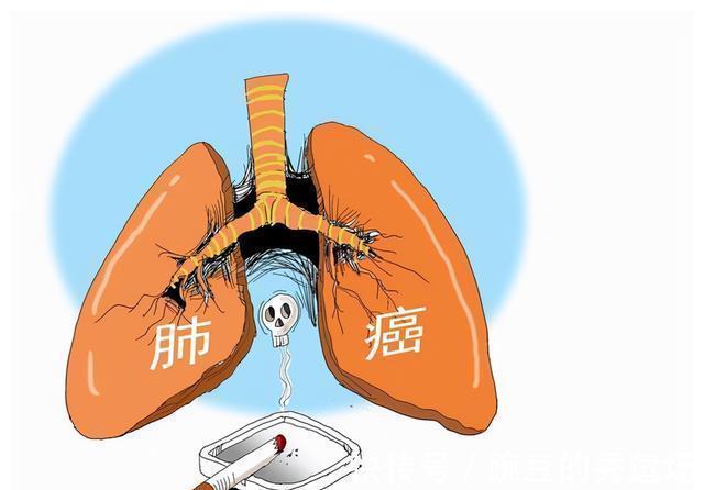 癌痛|中国常见的致癌“元凶”是这4种!注意避开