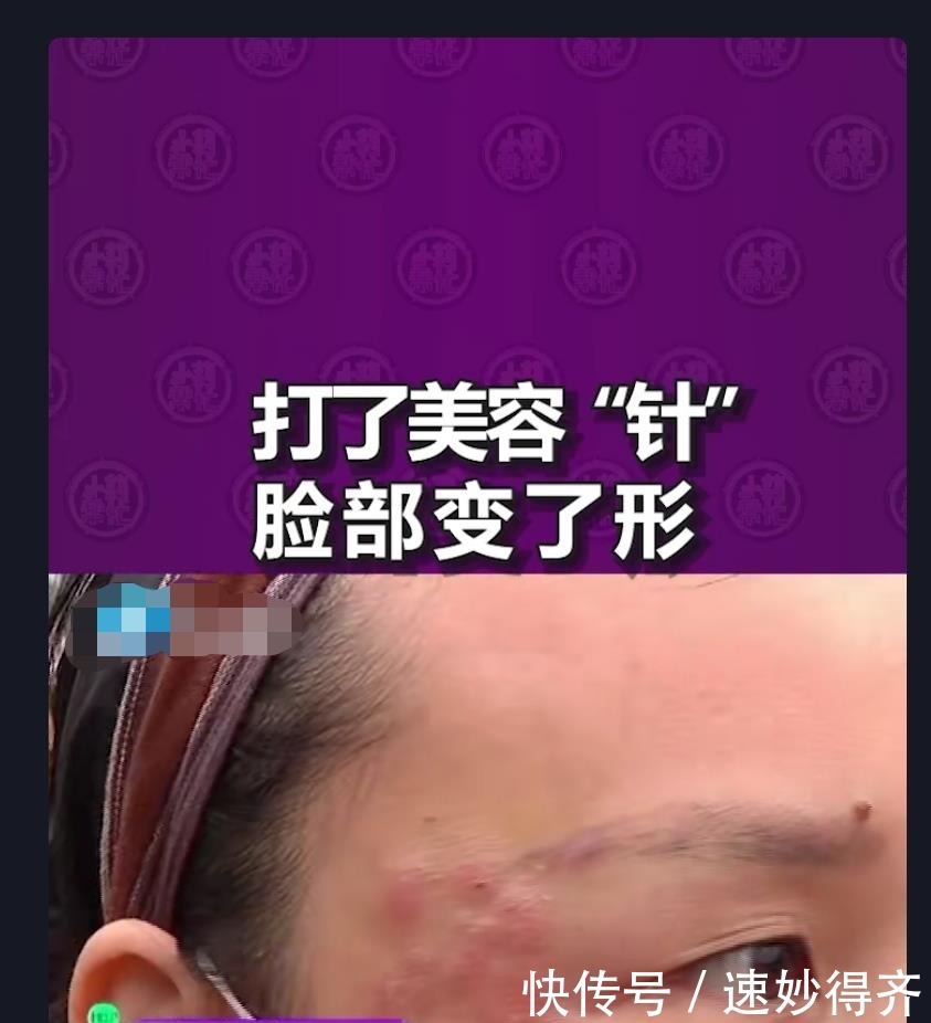 医学|生活美容和医学美容区别在哪里 前者成本低安全,后者风险大