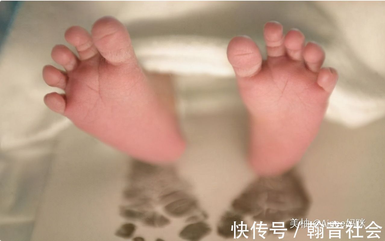 医护人员|新生儿宝宝出生后，为何医生要让宝妈确认性别，而不是先看脸？
