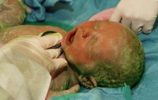 肚子|21岁怀孕八月肚子发痒,经医生检查后,她的脸却突然大变