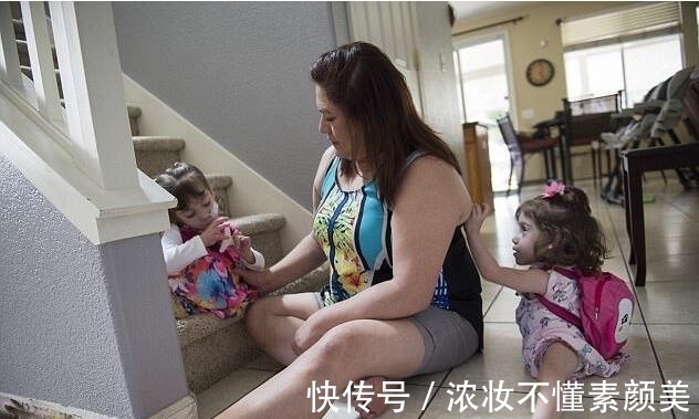 双胞胎|连体双胞胎做分离手术成功,每人分得一条腿,父母喜极而泣!