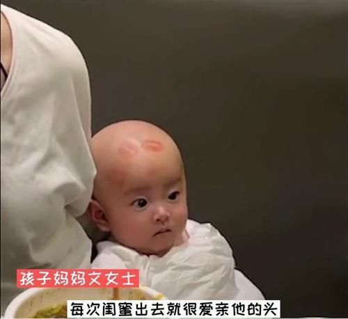 文女士|太可爱了!4个月萌娃光头上被妈妈的闺蜜亲了好几个唇印 醒来一脸懵