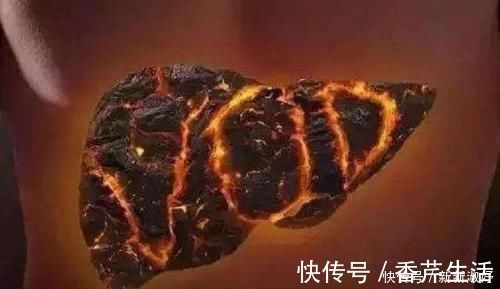 乙醛|肝脏有“4怕”，养肝“4要做”，每天一遍，肝“净”，早知早受益