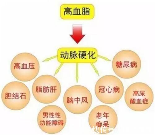 脑卒中|脑梗死预防大于治疗！医生坦言：注意几点就可轻松预防