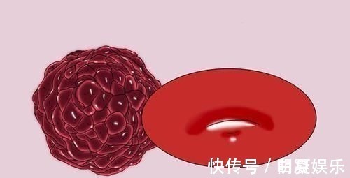 中国人|为什么同种癌症,有的患者六个月就走了,有人90岁依然活得很好