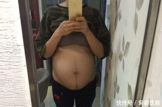 剖腹产|“生了两个娃，顺剖都经历了，两者各有利弊”