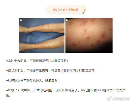 南昌|紧急提醒 ！南昌疾控：注意预防蠓虫叮咬！