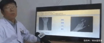 大风刮过,男子手掌还在,4指“不翼而飞”!