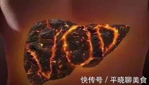 决明子|肝火旺长胖，内分泌失调，怎么办，这几招“降降火”，肝好痘消！