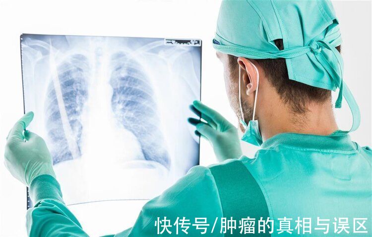 林丽珠|体检查出肺结节怎么办？名中医分享3款“食疗方”，结节或散得快