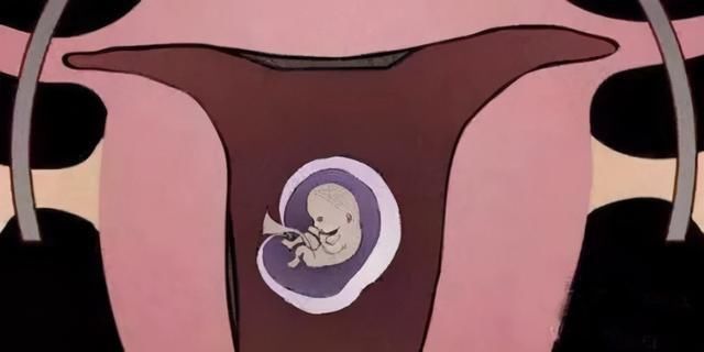 b超检查|子宫内膜息肉影响怀孕吗？