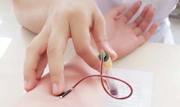 现带癌|07年查出肺癌晚期,现带癌生存17年,他分享了5条经验,值得借鉴