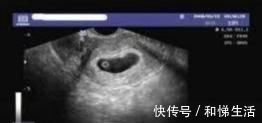 要领|准妈妈生男生女一看便知,再也不用去医院找医生鉴别了!