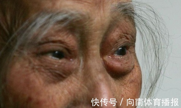 寿命|眉毛决定寿命长短,出现以下信号,可能是生病前兆,要小心
