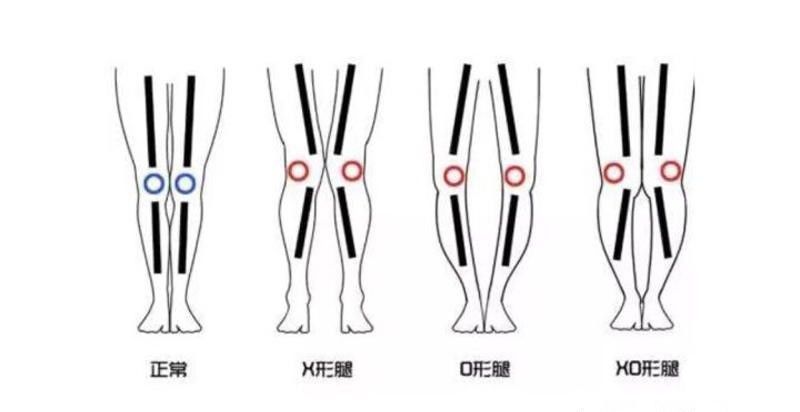 买靴子不是越贵越好，学会按照腿型来挑选，才能显瘦显腿长