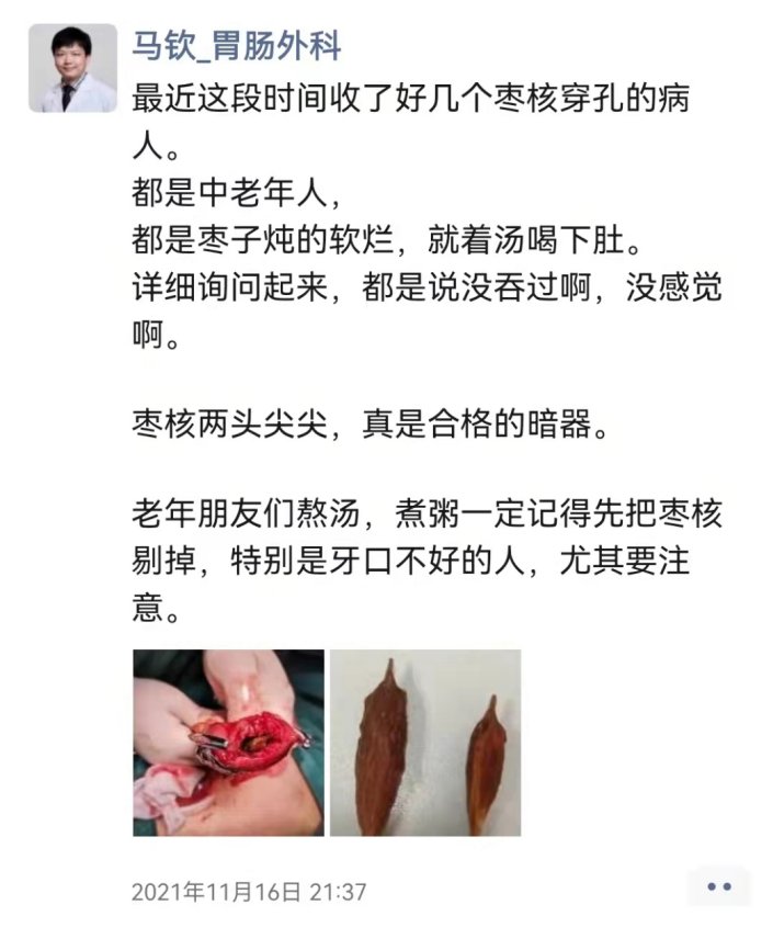 华西医生猛敲黑板：警惕这些吃进嘴的“暗器”，真的是男女老少通杀！