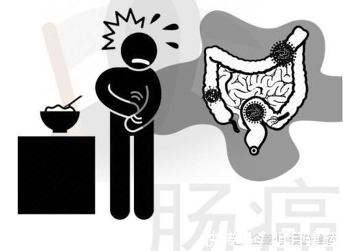 肠癌|常便秘的人若排便伴有2个症状,需当心,这或是肠癌在“搞事情”