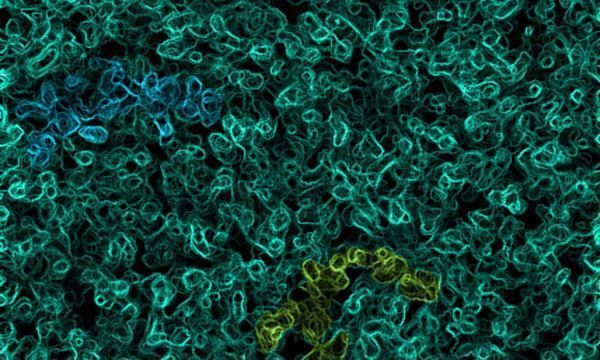 癌症也能被“治愈”医生直言若是能做到4点,你也是幸运儿