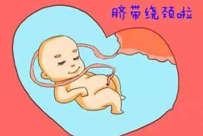 脐带脱垂|脐带异常的后果是什么怎么预防胎儿绕颈