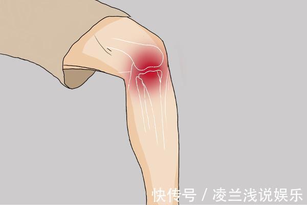 超标|尿酸升高,腿先知?腿部出现哪些异常,说明尿酸或已高到离谱了?