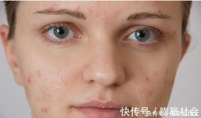 暗沉|为什么总是肤色暗沉？专家：肤色暗沉如何改善，可多吃八种食物