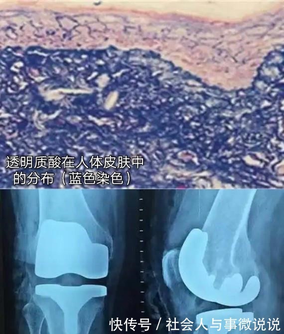 润百颜 玻尿酸的前生今世!护肤、口服、医美,竟然连TT里面都有添加!