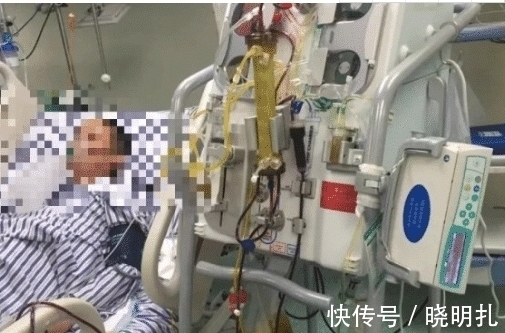 抢救|男子吃一顿火锅在ICU抢救一个月,你还敢胡乱吃东西吗