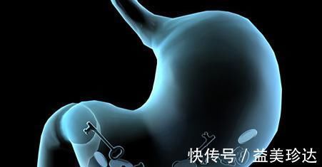 桂花茶|胃不好不要怕,常吃6种常见食物,可修复胃黏膜,胃病不来扰