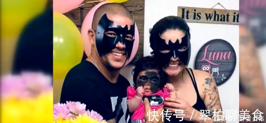 女孩|那个脸上有“蝙蝠”胎记的女孩,如今生活的怎么样?看完很欣慰