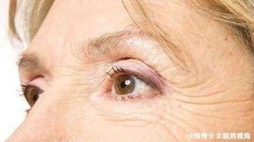 眼眶|防止皮肤松弛只能靠贵价肤护品？不！几招小动作让你青春永驻