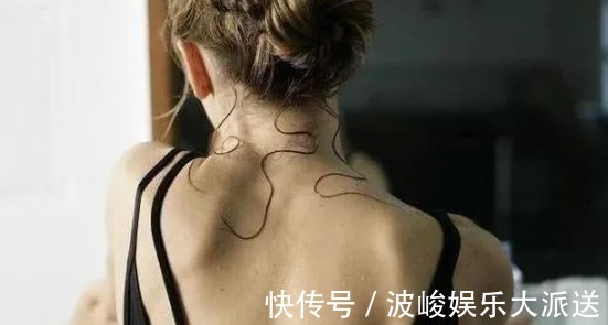 泥垢|螨虫堵塞背后毛孔时，会出现4个明显特征！来学3招除螨