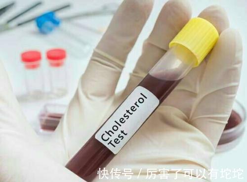血脂|血管堵塞想疏通，若想血脂健康，謹記：“2戒、3勤、4堅持”
