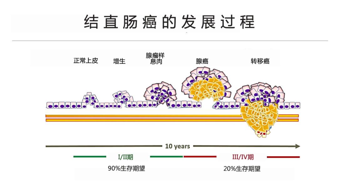 筛查|结肠息肉没切变肠癌，医生提醒这些人肠镜筛查不能省