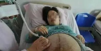 双胞胎|孕妇头胎生双胞胎女儿,二胎又怀双胞胎,丈夫:以后压力好大